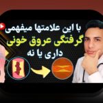 روندها، عوامل و راهکارهای کاهش ریسک مصدومیت گلف در ایران: راهنمای عملی برای بازیکنان گلف